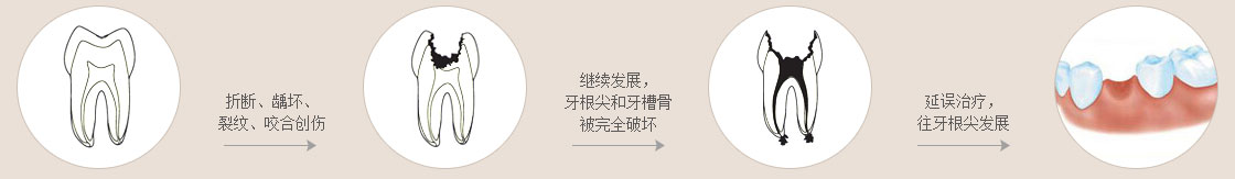 從牙髓炎到根尖炎的病變過(guò)程